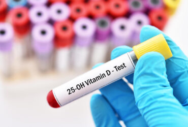 Evde D Vitamini Testi