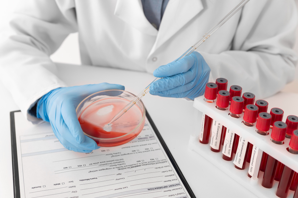 Evde Hematoloji Doktoru