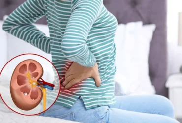 Böbrek Taşı Böbrek Taşı