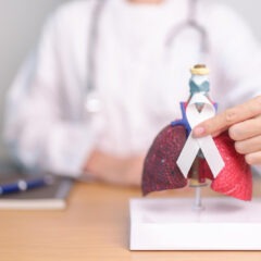 Akciğer Kanseri Belirtileri Nelerdir? Teşhis ve Tedavi Yöntemleri