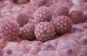 hpv