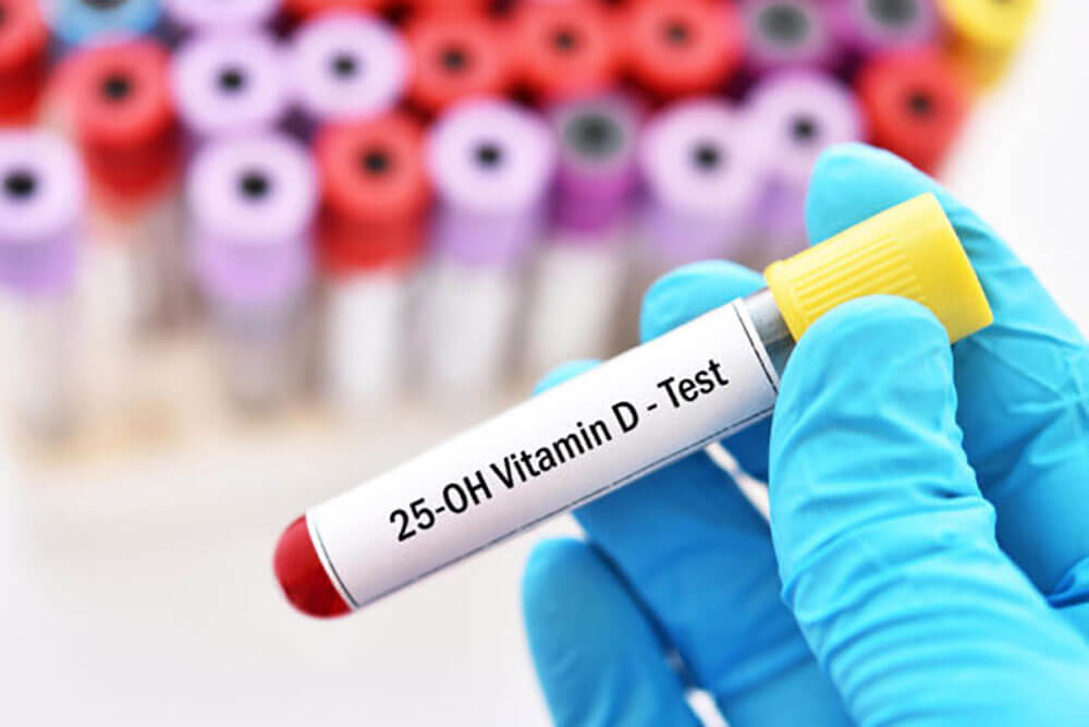 Evde D Vitamini Testi